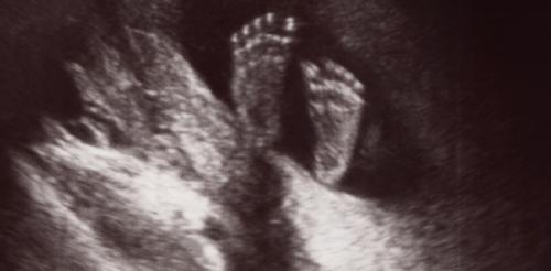 бебе во матката