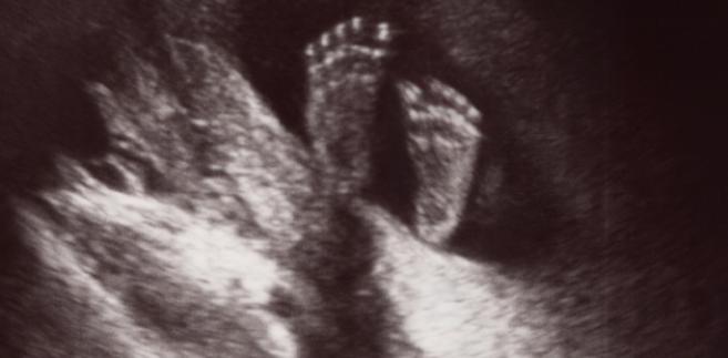 бебе во матката